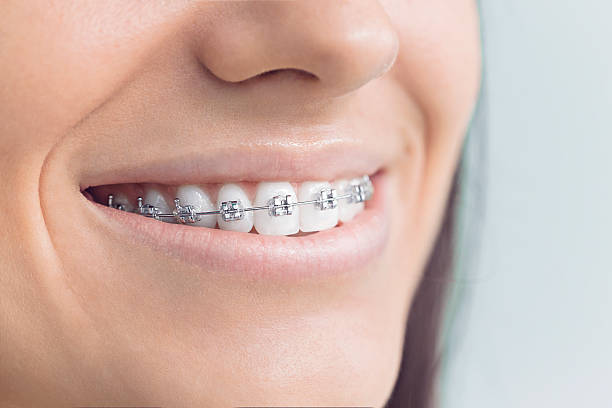 Best Full Mouth Reconstruction  in Urbana, OH